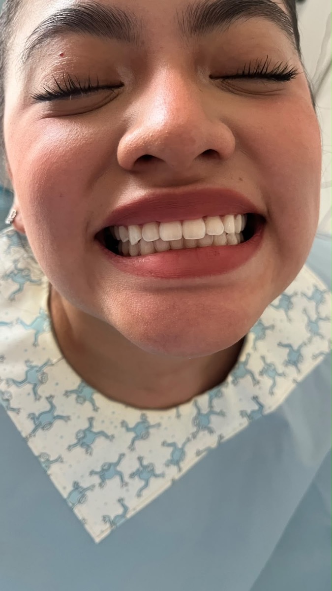 Sonrisa de una paciente